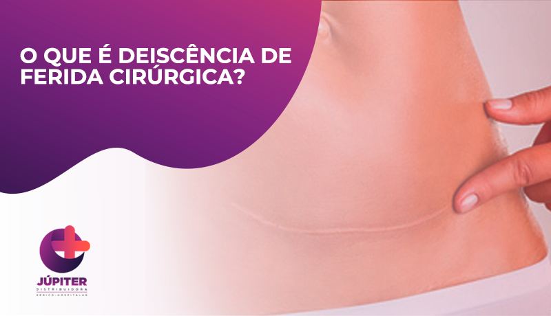 Ooforectomia e Ooforoplastia: causas e tratamentos